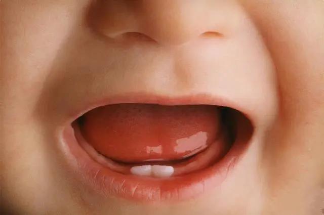 宝宝几个月长牙？多留意出牙前的这4个“信号”